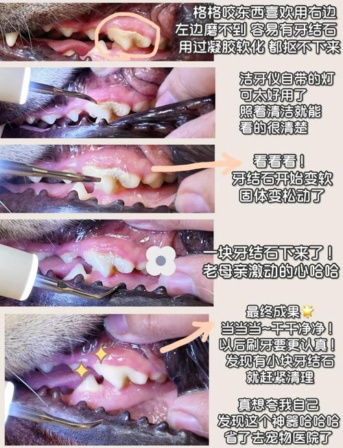 清除牙结石的好方法有哪些?不同人群如何选择安全有效的方案,日常护理能替代专业洗牙吗?-图1 清除牙结石的好方法有哪些?不同人群如何选择安全有效的方案,日常护理能替代专业洗牙吗?-图1