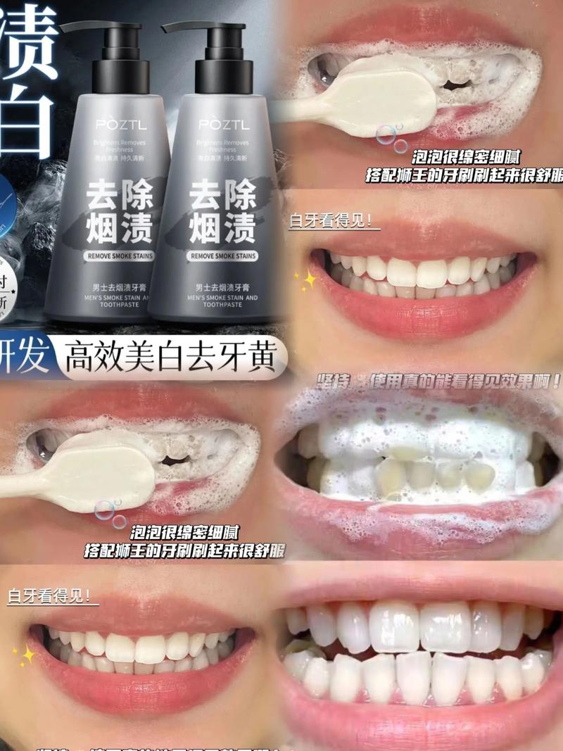 牙齿上的顽固烟渍如何有效去除？有哪些安全又实用的方法能快速恢复牙齿洁白？-图3