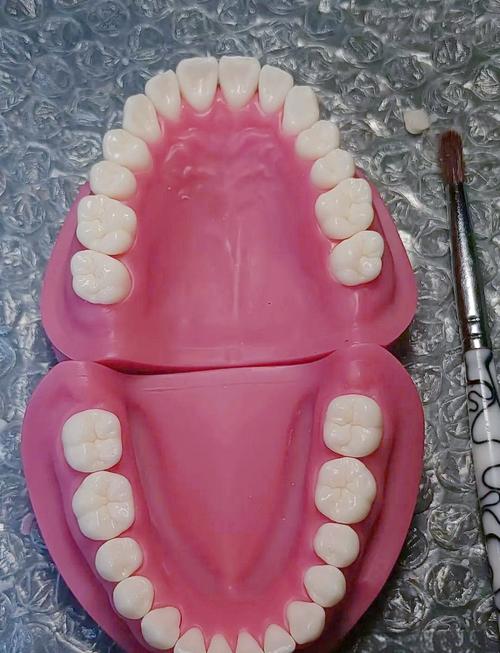 正畸咬合牙齿模型图在牙齿矫正中具体能直观呈现哪些咬合问题？对制定个性化矫正方案有何关键指导意义？-图2