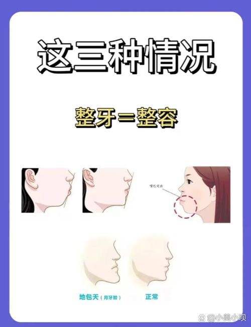 正畸治疗过程中下巴形态发生变化，究竟与牙齿移动的力学作用、骨骼改建机制还是肌肉功能调整相关？-图1