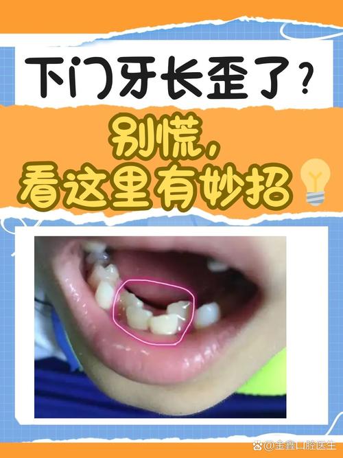 拔牙正畸后下门牙松动，是治疗过程中的正常现象还是异常信号？需要采取什么措施应对？-图3