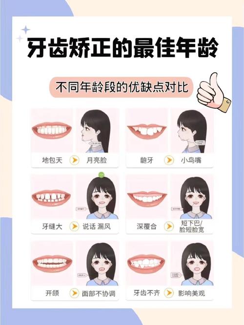 牙齿不齐的治疗方法-图2