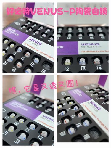 上海正畸科医院哪家强？技术、口碑、性价比怎么选，适合你的好医院藏在哪？-图3