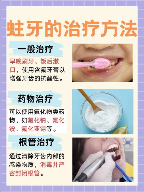 蛀牙程度不同,治疗虫牙的最佳方法差异大?如何科学选择补牙、根管治疗还是拔牙?-图1 蛀牙程度不同,治疗虫牙的最佳方法差异大?如何科学选择补牙、根管治疗还是拔牙?-图1