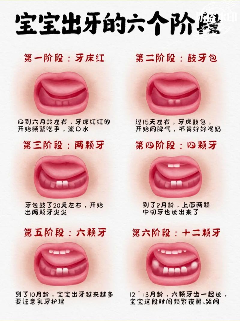 种牙后多久才能长出自然牙？影响因素有哪些？不同人群时间差异大吗？-图2