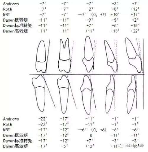 正畸打转矩到底是什么？为何这个操作能精准控制牙齿角度？看完讲解视频你就懂了！-图3