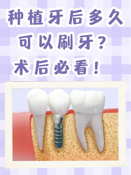 种牙后到底几天才能吃辣？饮食恢复期吃辣会影响伤口愈合吗？医生建议的忌口期到底多久？-图3