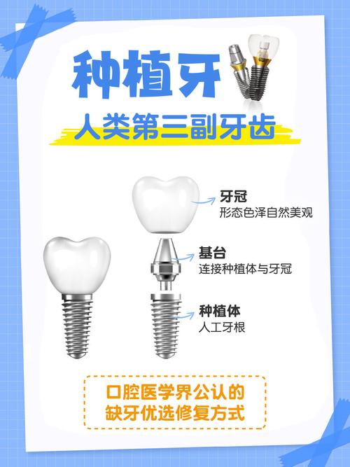 牙齿缺失后,哪些情况必须通过种牙解决?补牙和镶牙无法替代时,种牙是唯一选择吗?-图1 牙齿缺失后,哪些情况必须通过种牙解决?补牙和镶牙无法替代时,种牙是唯一选择吗?-图1