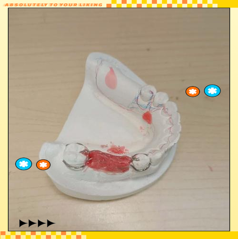 口腔正畸卡环弯制视频教学中，如何快速掌握不同类型卡环的弯制要领与临床应用技巧？-图1