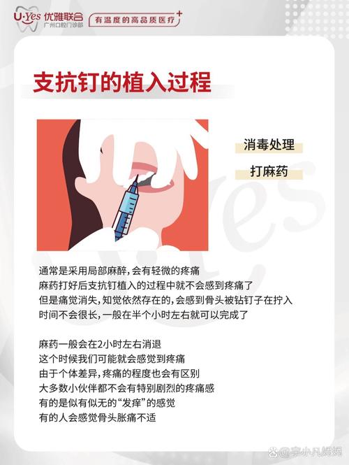 种植支抗钉植入的具体操作步骤有哪些？不同牙位植入时如何选择入路角度及避免损伤重要解剖结构？-图1