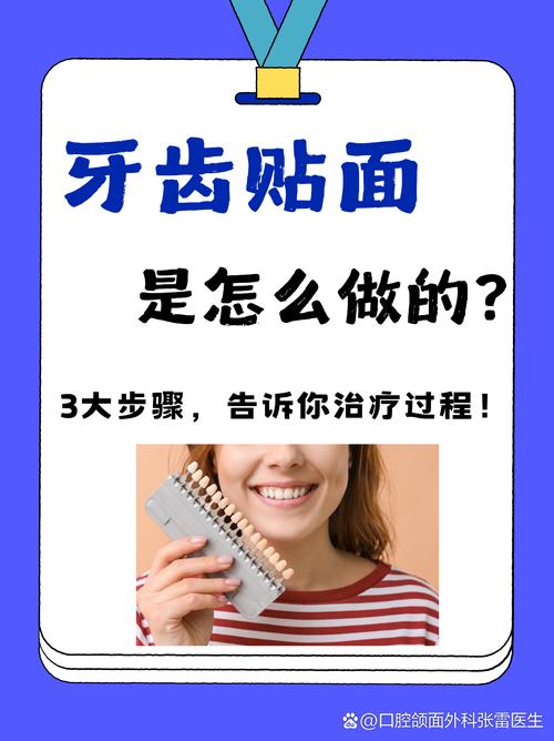牙齿贴面预备方法的选择需考虑哪些因素？不同牙体条件下如何优化预备步骤以兼顾美观与牙体健康？-图2