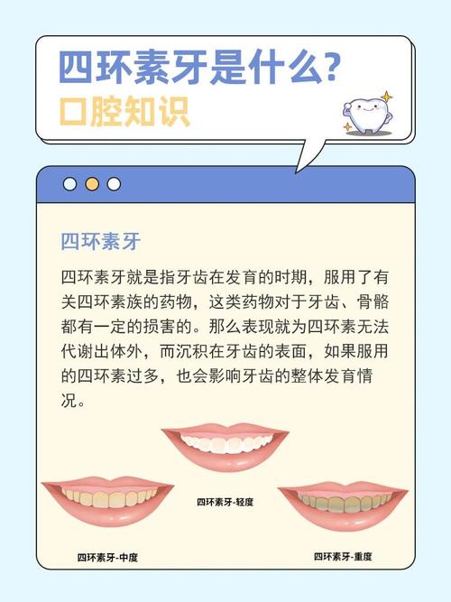 四环素牙齿美白方法有哪些?不同方法的效果如何,是否存在风险,又该如何科学选择?-图2 四环素牙齿美白方法有哪些?不同方法的效果如何,是否存在风险,又该如何科学选择?-图2