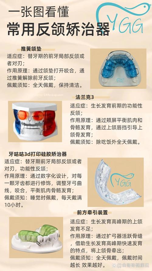 反颌矫正器的制作方法有哪些技术要点?不同反颌类型(如骨性、牙性)的定制方案有何差异?材料选择如何影响矫正效果与佩戴舒适度?-图1 反颌矫正器的制作方法有哪些技术要点?不同反颌类型(如骨性、牙性)的定制方案有何差异?材料选择如何影响矫正效果与佩戴舒适度?-图1