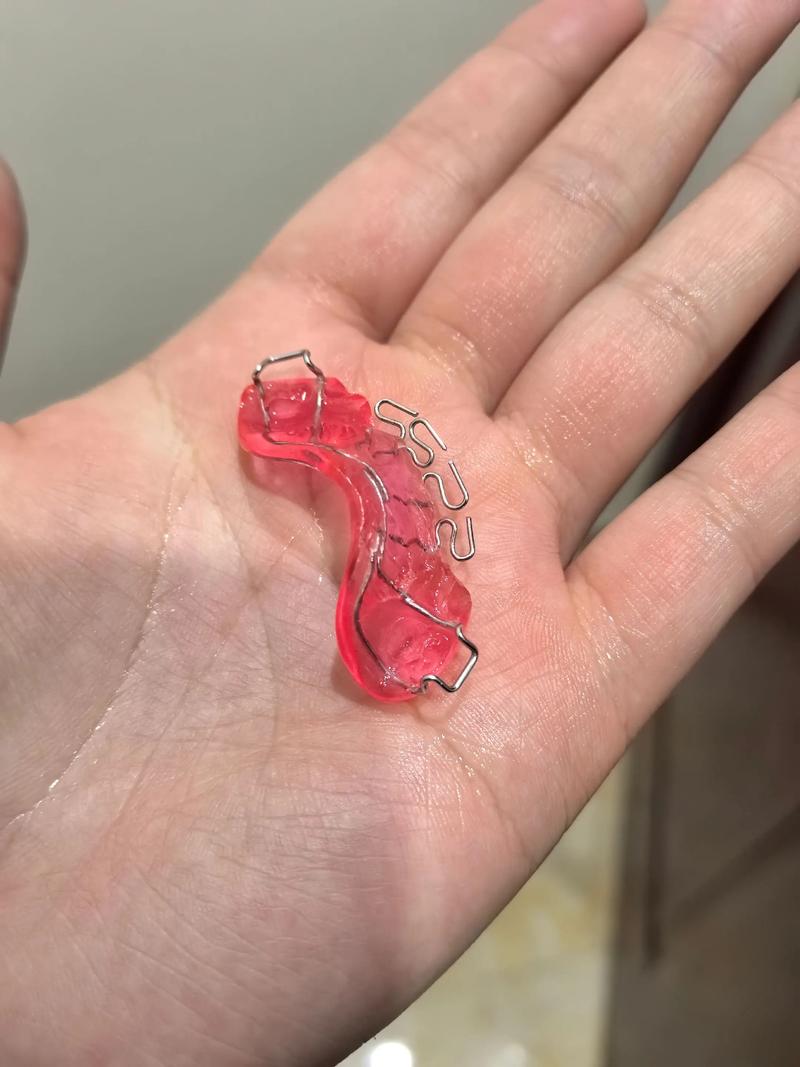 反颌矫正器的制作方法有哪些技术要点?不同反颌类型(如骨性、牙性)的定制方案有何差异?材料选择如何影响矫正效果与佩戴舒适度?-图3 反颌矫正器的制作方法有哪些技术要点?不同反颌类型(如骨性、牙性)的定制方案有何差异?材料选择如何影响矫正效果与佩戴舒适度?-图3