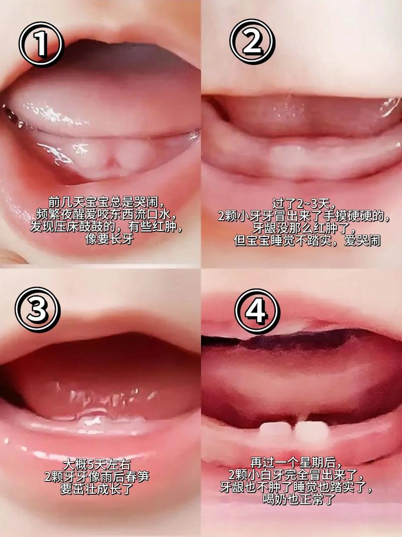 孩子种牙的最佳时间究竟是什么？错过不同年龄段会有哪些发育风险？-图2