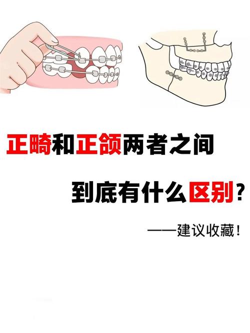 除了正畸，牙齿矫正还有哪些分类？不同矫正方式的特点和适用人群分别是什么？-图2