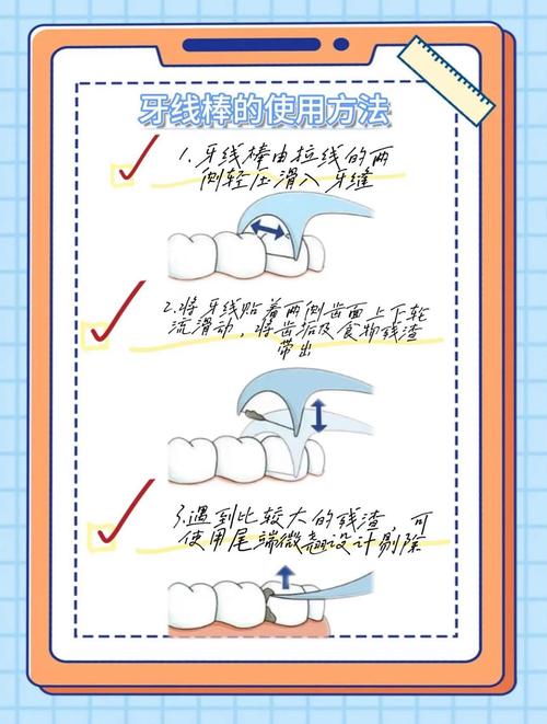弓形牙线是什么?它与普通牙线有何区别?正确使用步骤是怎样的?有哪些注意事项需要牢记?-图2 弓形牙线是什么?它与普通牙线有何区别?正确使用步骤是怎样的?有哪些注意事项需要牢记?-图2