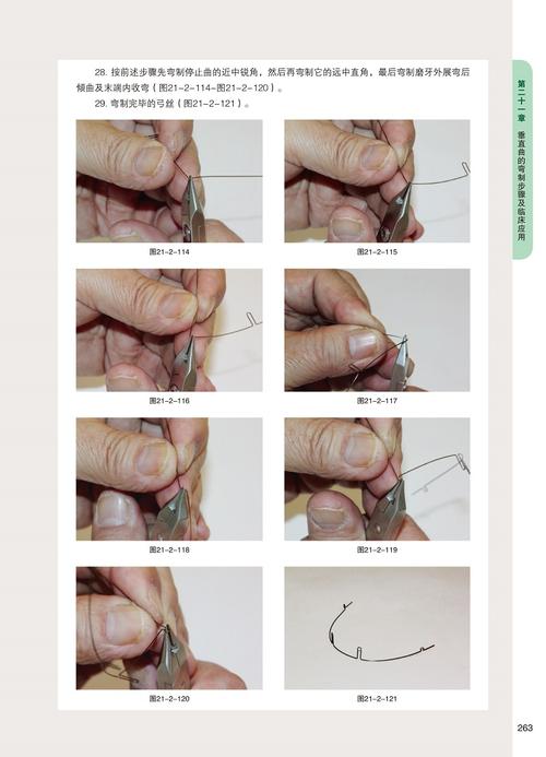 正畸标准弓形弯制的核心要点有哪些？不同错颌畸形患者弯制时需注意哪些关键差异？-图3