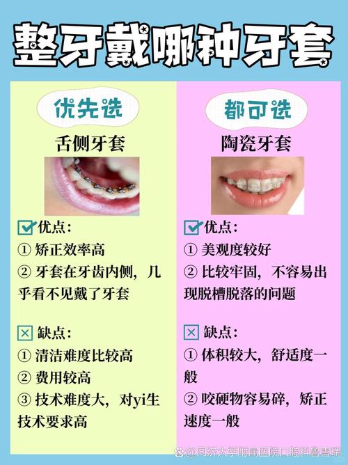 做牙套好还是种牙好？两者适用情况、优缺点及长期效果大PK，到底该怎么选？-图2