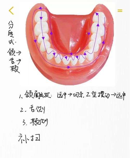 口腔吸盘的正确使用方法是什么?新手操作时有哪些常见误区及详细步骤需注意?-图1 口腔吸盘的正确使用方法是什么?新手操作时有哪些常见误区及详细步骤需注意?-图1