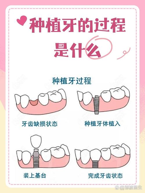 种牙后临牙出现松动是正常现象吗？背后原因和应对方法详解-图3