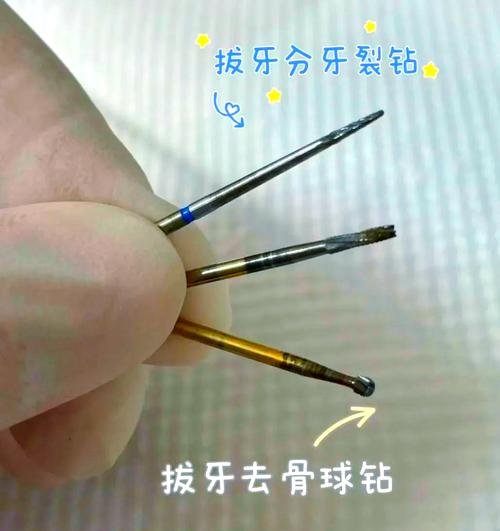 牙齿探针的正确使用方法是什么?新手操作时需注意哪些关键步骤和常见错误?-图1 牙齿探针的正确使用方法是什么?新手操作时需注意哪些关键步骤和常见错误?-图1