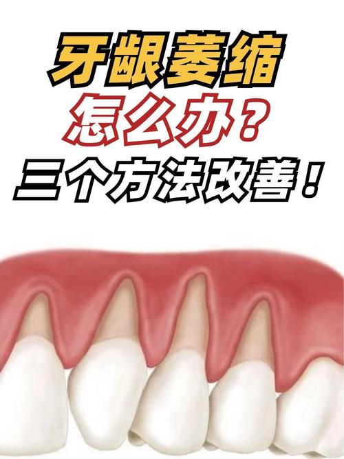 牙龈萎缩患者可以通过哪些食疗方法有效改善症状?日常饮食中需要补充哪些营养素才能促进牙龈修复?-图3 牙龈萎缩患者可以通过哪些食疗方法有效改善症状?日常饮食中需要补充哪些营养素才能促进牙龈修复?-图3