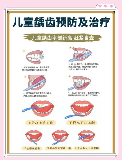儿童预防蛀牙，家长日常护理中存在哪些常见误区？如何正确有效预防？-图2