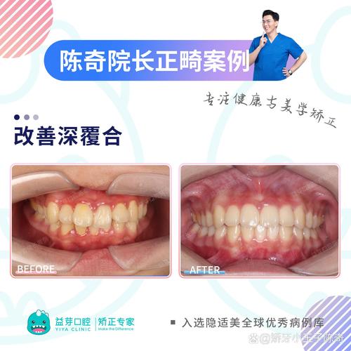 上海想做牙齿正畸,如何找到技术好、价格透明且医生经验丰富的靠谱机构?-图1 上海想做牙齿正畸,如何找到技术好、价格透明且医生经验丰富的靠谱机构?-图1
