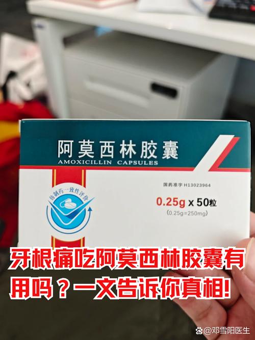 种牙后吃什么消炎药合适?术后恢复期如何选药?吃多久才有效?要注意哪些禁忌?-图2 种牙后吃什么消炎药合适?术后恢复期如何选药?吃多久才有效?要注意哪些禁忌?-图2