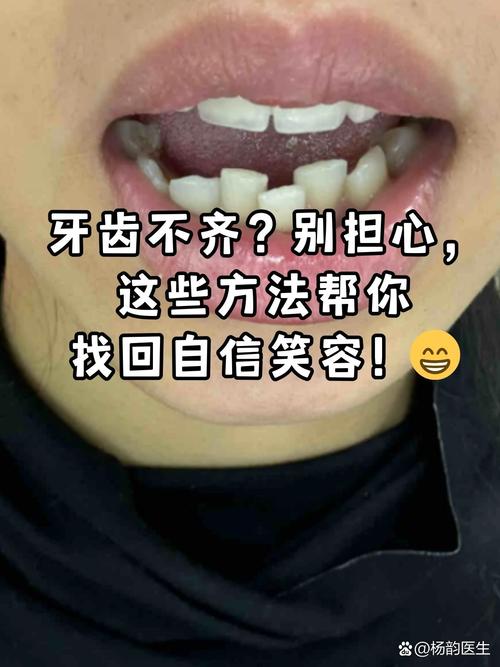 牙不齐有哪些矫正方法？传统牙套、隐形矫正等不同方式的优缺点和适用人群如何选择？-图1