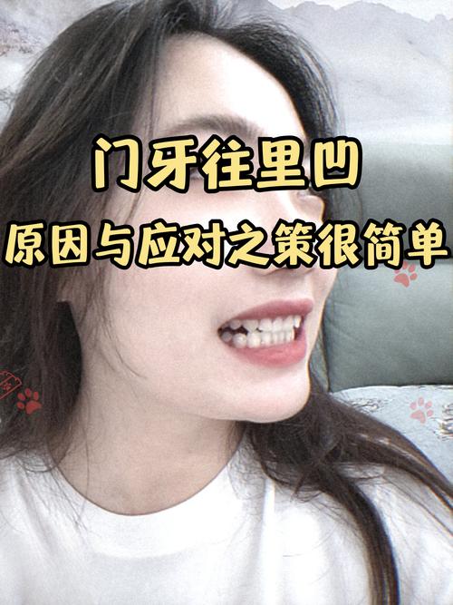 牙不齐有哪些矫正方法？传统牙套、隐形矫正等不同方式的优缺点和适用人群如何选择？-图3