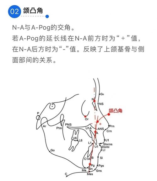 Z角作为正畸测量数据的关键指标,其在面部美学分析与治疗方案设计中究竟具有哪些核心临床意义?-图2 Z角作为正畸测量数据的关键指标,其在面部美学分析与治疗方案设计中究竟具有哪些核心临床意义?-图2