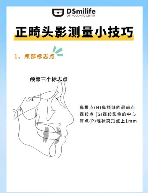 Z角作为正畸测量数据的关键指标,其在面部美学分析与治疗方案设计中究竟具有哪些核心临床意义?-图1 Z角作为正畸测量数据的关键指标,其在面部美学分析与治疗方案设计中究竟具有哪些核心临床意义?-图1