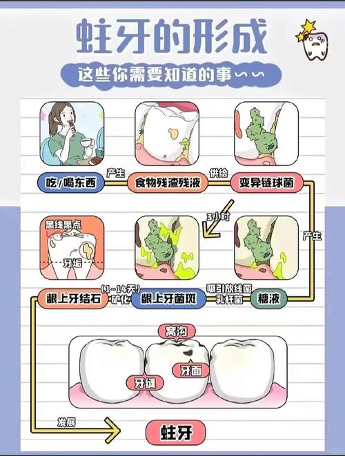 预防龋齿的有效方法有哪些?日常刷牙、饮食调整与专业涂氟如何协同作用?-图2 预防龋齿的有效方法有哪些?日常刷牙、饮食调整与专业涂氟如何协同作用?-图2