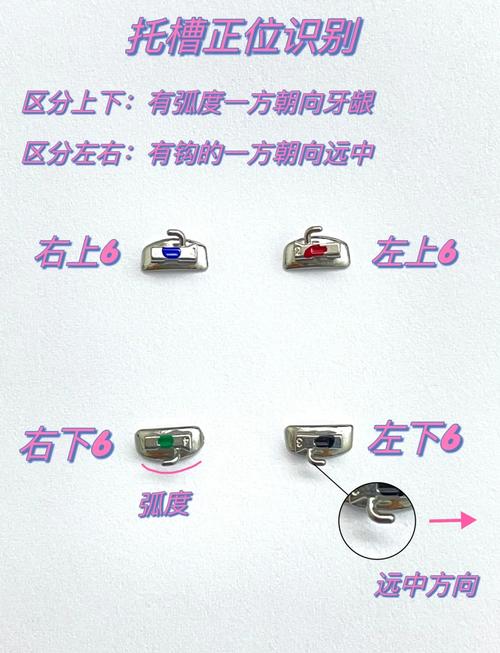 口腔正畸托槽粘接有哪些方法？不同粘接技术的步骤和注意事项是什么？-图2