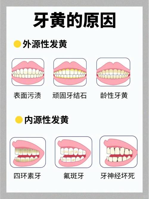 牙齿变白有哪些方法？不同美白方式的效果、安全性如何？普通人该如何科学选择适合自己的牙齿美白方案？-图2