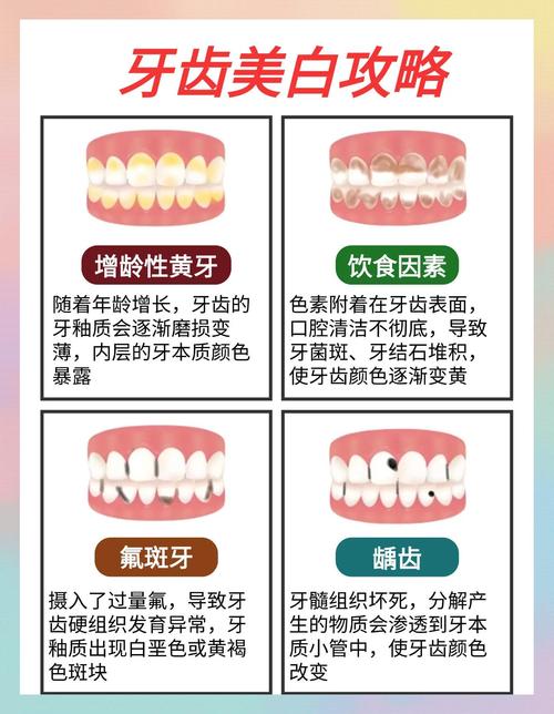 牙齿变白有哪些方法？不同美白方式的效果、安全性如何？普通人该如何科学选择适合自己的牙齿美白方案？-图3