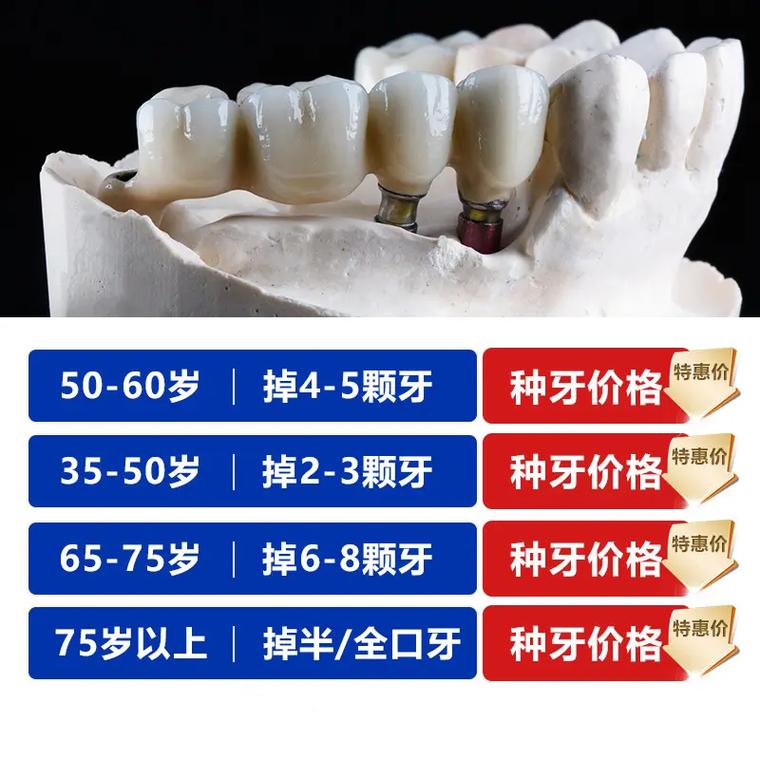 美国种牙一颗费用差异为何这么大?不同城市、医院等级、种植体品牌价格有何不同?是否包含基台、牙冠及术后复查费用?-图2 美国种牙一颗费用差异为何这么大?不同城市、医院等级、种植体品牌价格有何不同?是否包含基台、牙冠及术后复查费用?-图2