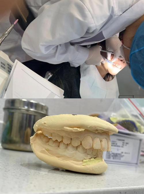 南京第一医院口腔正畸效果如何?医生技术好不好?价格贵不贵?适合哪些牙齿问题呢?-图2 南京第一医院口腔正畸效果如何?医生技术好不好?价格贵不贵?适合哪些牙齿问题呢?-图2