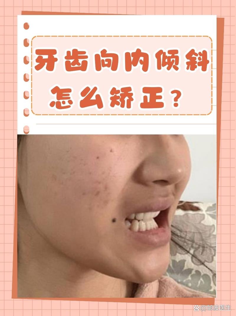 正畸过程中下牙内倾是什么原因导致的？会对咬合功能和面部美观产生哪些影响？-图1
