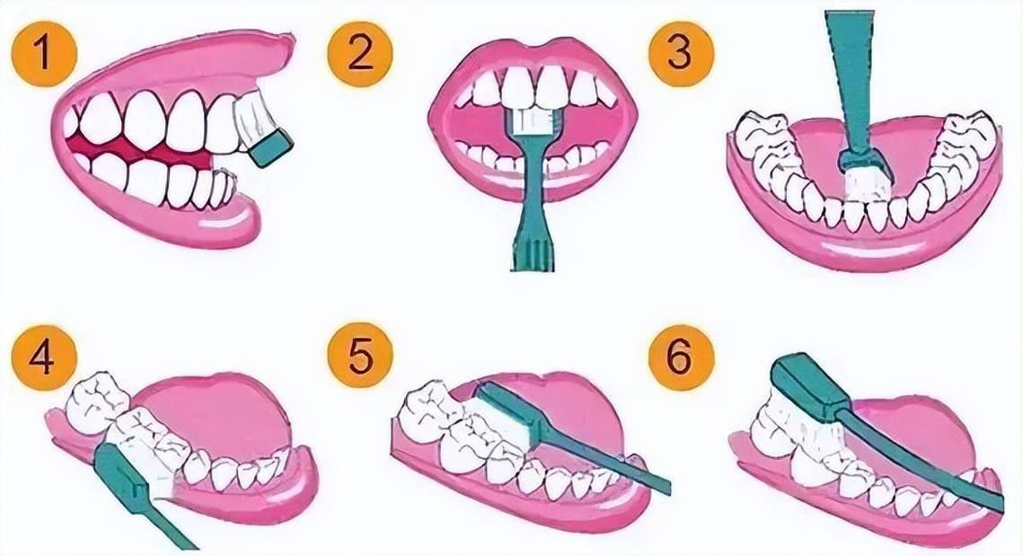 为什么选择动画形式演示正确刷牙方法?它能直观展示哪些手动难以传递的细节,帮助不同人群高效掌握关键技巧?-图2 为什么选择动画形式演示正确刷牙方法?它能直观展示哪些手动难以传递的细节,帮助不同人群高效掌握关键技巧?-图2