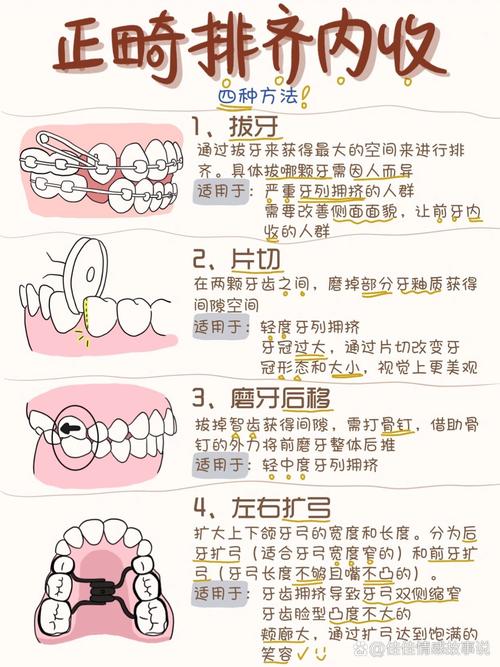 矫正牙齿有哪些常见方法？不同方法适合哪些人群，如何选择最适合自己的矫正方式？-图1
