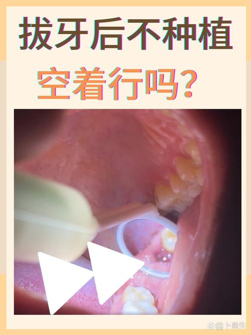 拔牙后若一直不种牙，邻牙真的会歪斜、牙槽骨会加速萎缩吗？对身体还有哪些隐藏影响？-图1