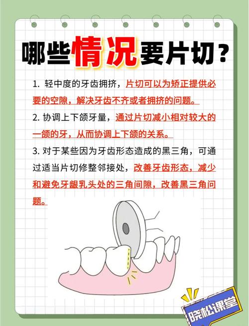 正畸富士0去除的正确方法是什么?操作时需注意哪些事项以避免牙齿损伤?-图1 正畸富士0去除的正确方法是什么?操作时需注意哪些事项以避免牙齿损伤?-图1