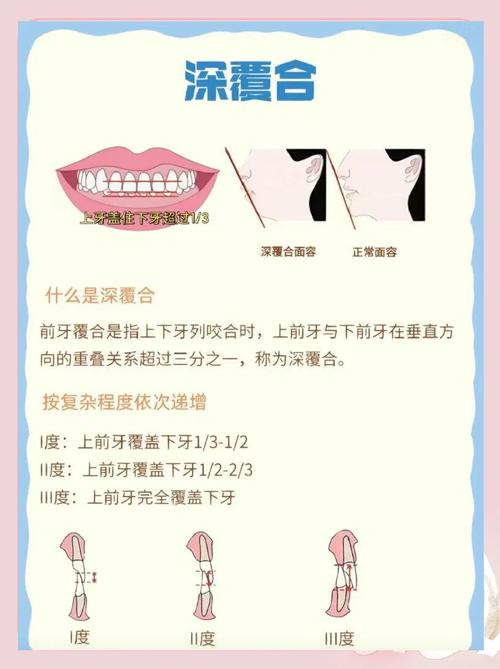 深覆合能否通过自我矫正有效改善?具体方法有哪些科学依据及风险需警惕?-图2 深覆合能否通过自我矫正有效改善?具体方法有哪些科学依据及风险需警惕?-图2