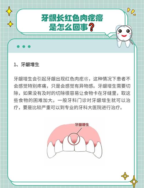 牙龈增生有哪些治疗方法?不同病因导致的增生治疗方式有何差异?如何根据增生程度选择合适的治疗手段?-图2 牙龈增生有哪些治疗方法?不同病因导致的增生治疗方式有何差异?如何根据增生程度选择合适的治疗手段?-图2