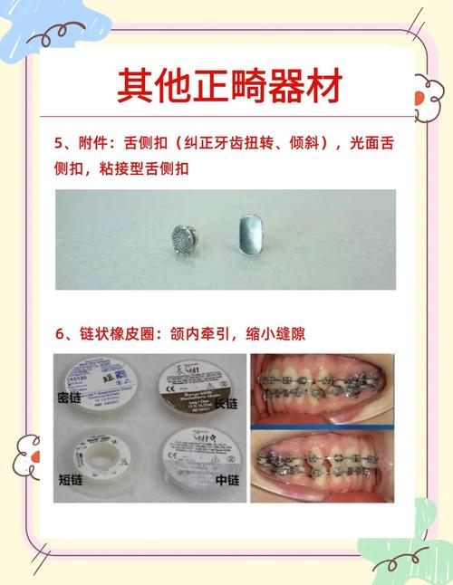 口腔正畸支抗钉型号多样，不同型号在临床适用情况、选择关键因素及治疗效果上存在哪些差异？-图2