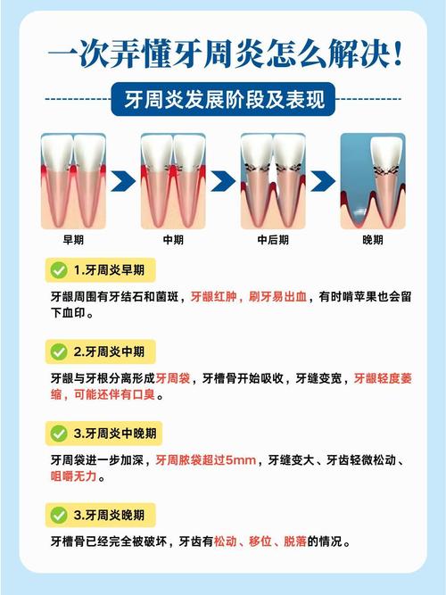 牙周炎治疗方法有哪些？不同严重程度患者该如何选择？治疗后如何有效预防复发？-图1
