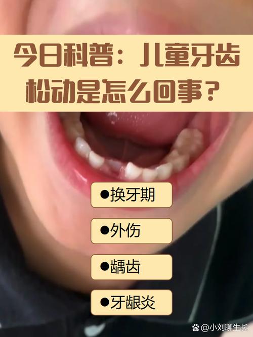 正畸期间牙齿松动是正常现象吗？原因是什么，会影响牙齿健康和矫正效果吗？-图3